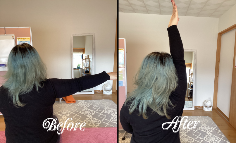 肩関節右外転可動域改善