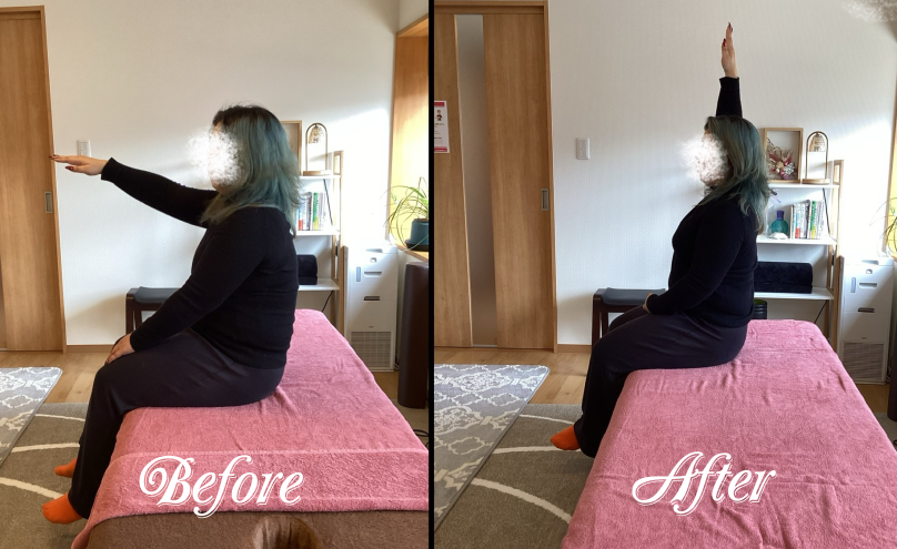 肩関節左屈曲可動域改善